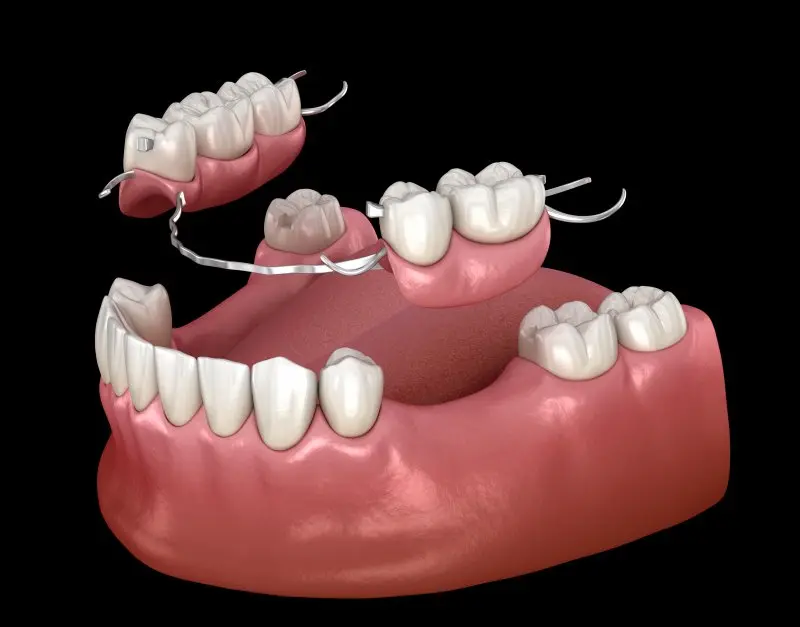 dental